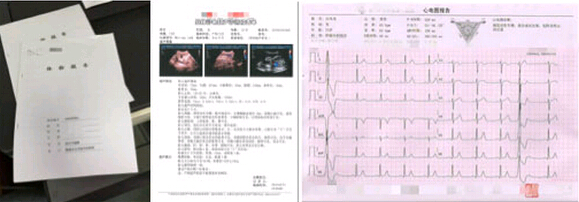 該院體檢中心的體檢報(bào)告示例 該院體檢中心的體檢報(bào)告示例